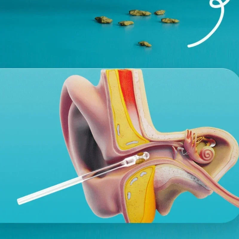 YS00115 ---Stickable Sticky Ear Stick Ear Cleanser Soft Silicone Removal Tool for Men, Women and Children